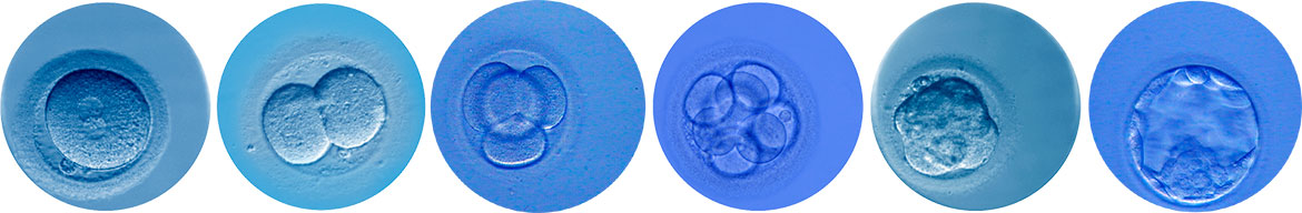 Images from a blastocyst culture