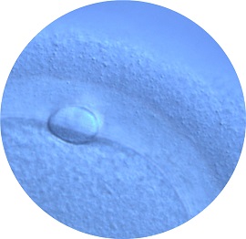 Egg vitrification - Microscopic view